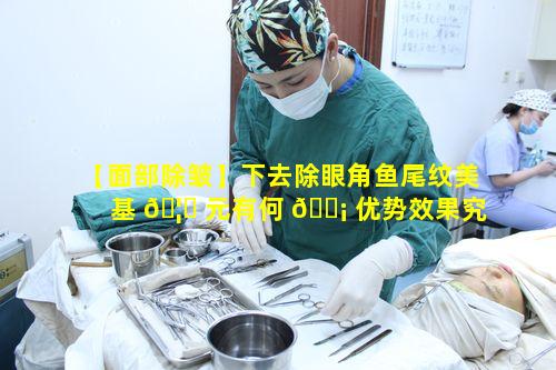 【面部除皱】下去除眼角鱼尾纹美基 🦍 元有何 🐡 优势效果究竟如何体现